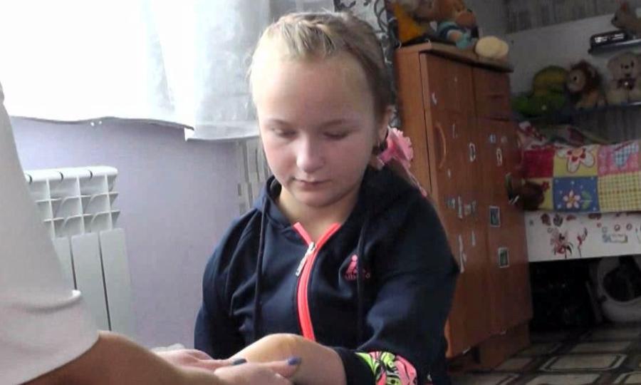 Для помощи 12-летней Дарине из Вельска остаётся собрать ещё 70 тысяч рублей